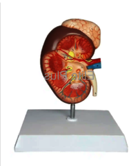 ZX-1439PN Kidney with Adrenal Gland, Enlarged