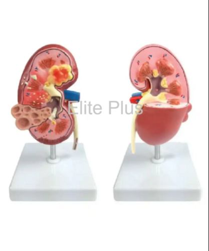 ZX-1513P Kidney Pathologies Model