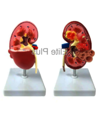 ZX-1513P Kidney Pathologies Model