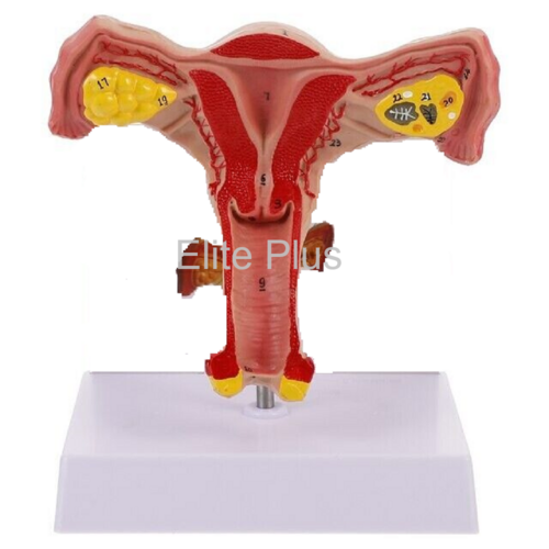 ZX-1441PN Female Uterus Ovary Model