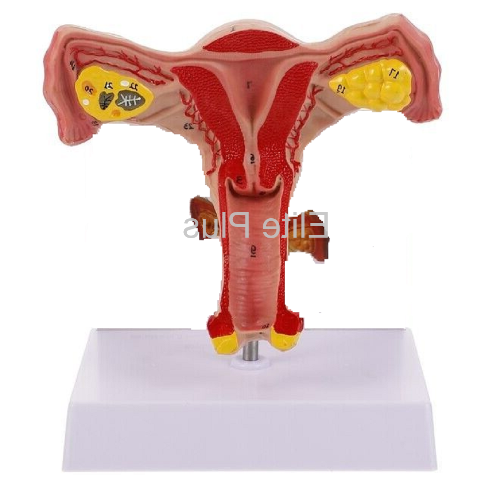 ZX-1441PN Female Uterus Ovary Model