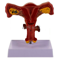 ZX-1441PN Female Uterus Ovary Model