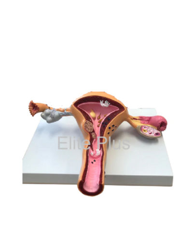 Zx-1516p Uerus & Ovary Pathalogies Model