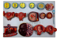 ZX-1712PN Human Fertilization and Embryogeny Model