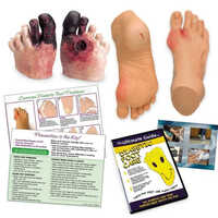 Natural Complete Diabetic Foot Care Kit
