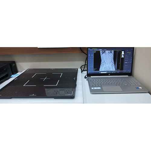 Metal Retrofit Digital Radiography System