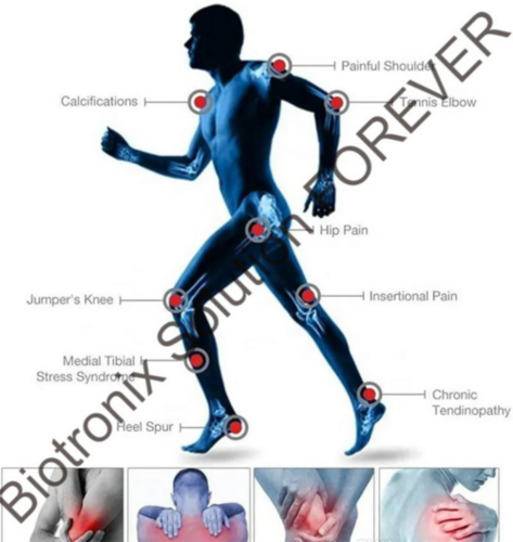 Shockwave Touch screen shock wave therapy machine for precise and effective therapy