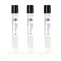 Prp Tubes - Plastic, Blue | Portable For Laboratory Use, 1-year Shelf Life, Ideal For Clinics
