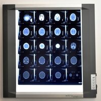 Single Screen High End Led X-ray Viewer