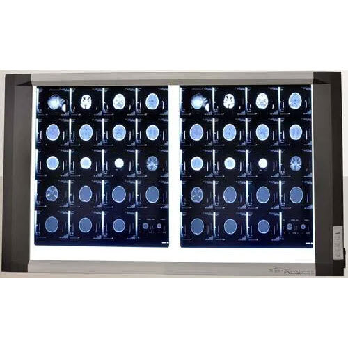 Double Screen High End LED X-Ray Viewer