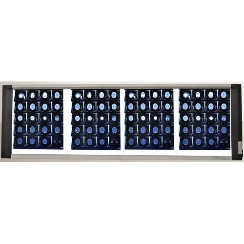 Four Screen High LED X-Ray Viewer