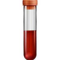 Hemoglobin Test Kit - Glass And Plastic, 15x1cm Size | Blood Sample, Colorimetric Method, 15-minute Test, 2-8â°c Storage, 1-year Shelf Life