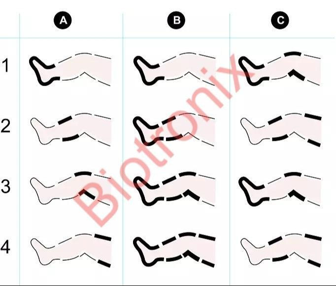 Compression therapy legs arms compression pump DVT arms legs compression pump