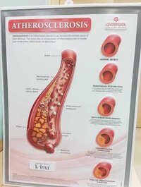 Thermoforming 3d Poster - Application: Industrial