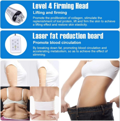 Cavitation RF Slimming Equipment LIPO LASER and RF Body Sculptor