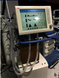 Refurbished Drager Evita Xl Ventilator - Configurable Parameters For 24h Monitoring, Alarm & Event Logbook With Background Alarm Features