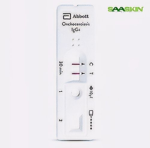 Abbott Bioline ONCHOCERCIASIS IgG4