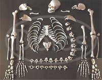 Disarticulated Skeleton model