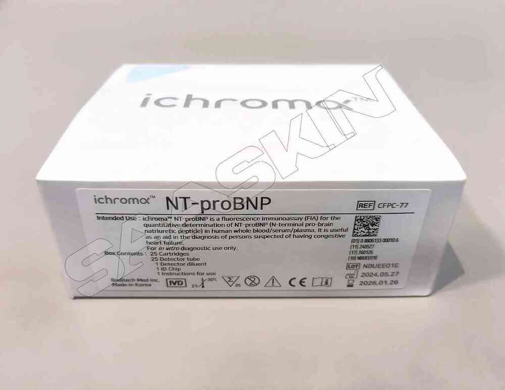 ichroma Prolactin (PRL)