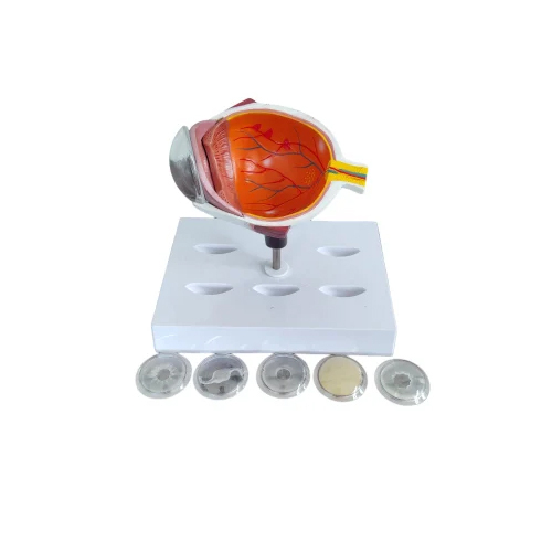 Cataract Eye Model