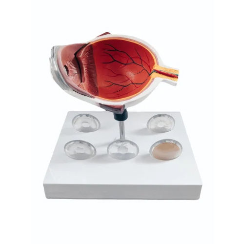 Glaucoma Eye Model - Color: Multi Colour