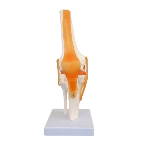 Knee Joint Model - Color: Multi Colour