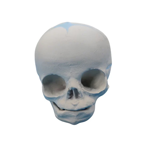 Fetal Skull Model