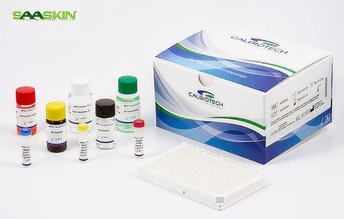 Calbiotech Cardiolipin IgA ELISA