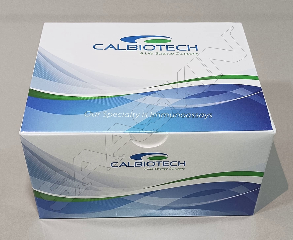 Calbiotech Mumps IgM ELISA