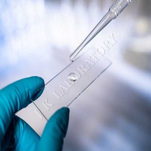 Fixed Carbon Testing Services