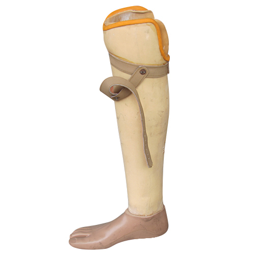 Prostheses Below Knee - Usage: Restores Mobility And Function For Individuals With Below-Knee Amputations