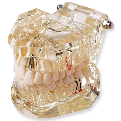 Transparent Dental Model - Durable PVC, Natural Color , Ideal for Educational Purposes and In-Depth Tooth Anatomy Visualization