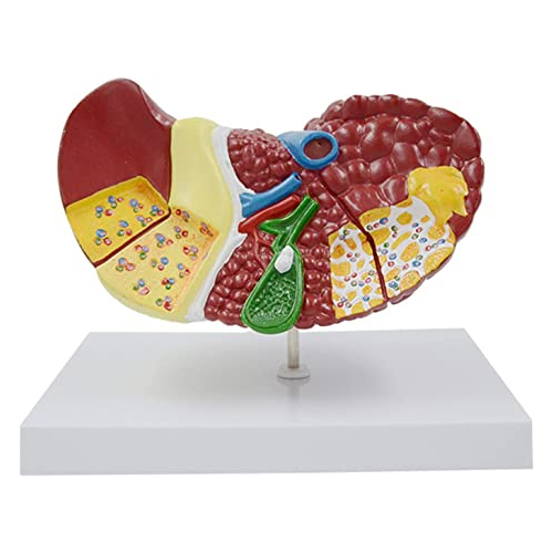 Human Liver Anatomical Model Liver Damage Model