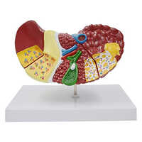Human Liver Anatomical Model Liver Damage Model