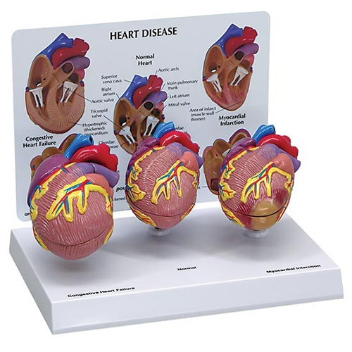 3-Mini Heart Model Set