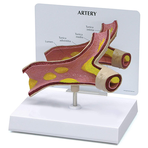 Artery Model