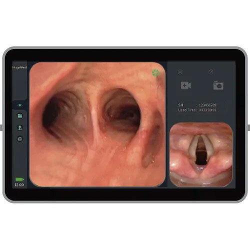 Video Bronchoscope - Application: Medical Use