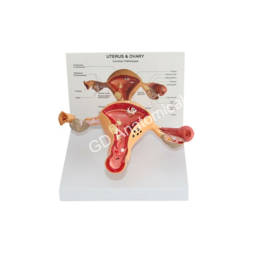 Uterus And Ovary Model