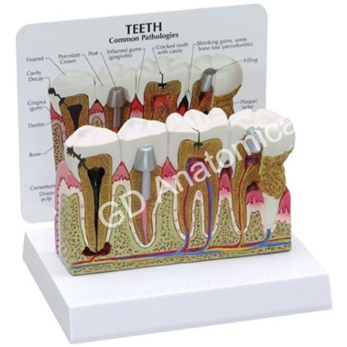 Teeth Common Model