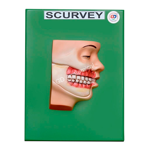 Scurvy Model