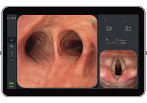 Video Bronchoscope Disposable