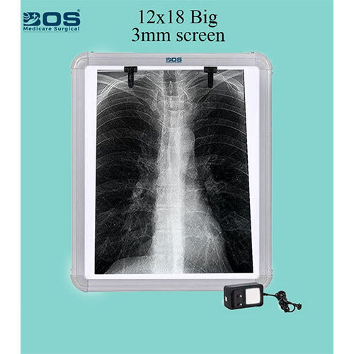 X-Ray View Box Single Flim - Application: Hospital & Clinic