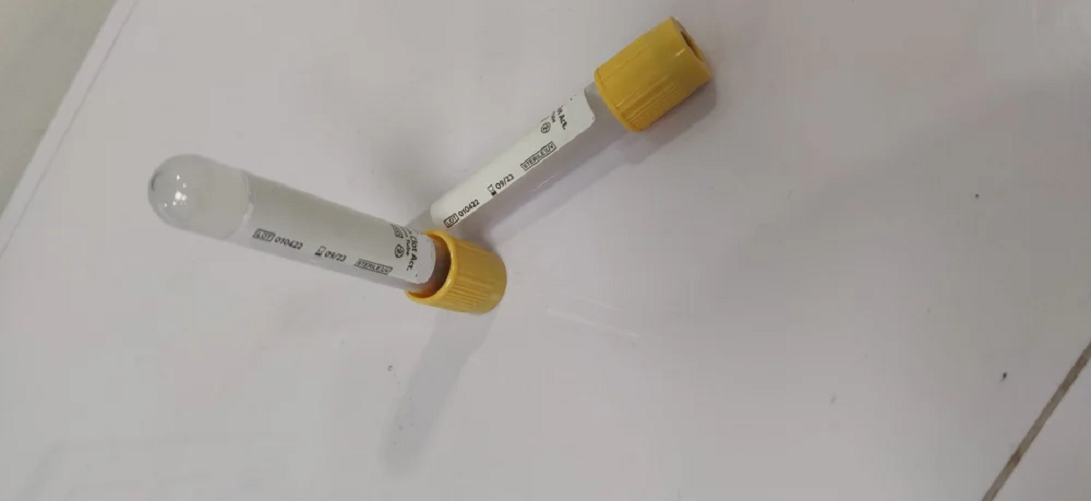 Vaccum Gel Blood Collection Tube