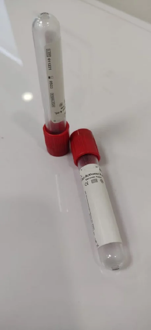 Vacuum Blood Collection Tube