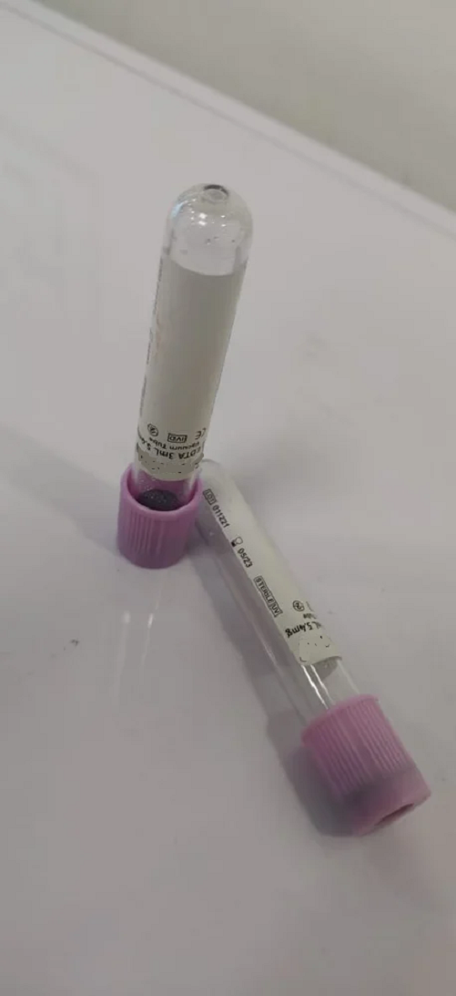 K3 EDTA Vacuum Blood Collection Tube