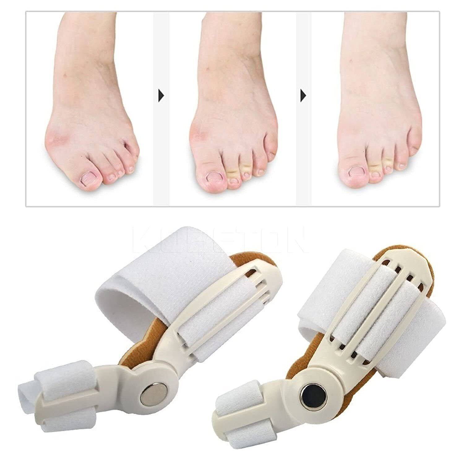 TOE STRAIGHTENER