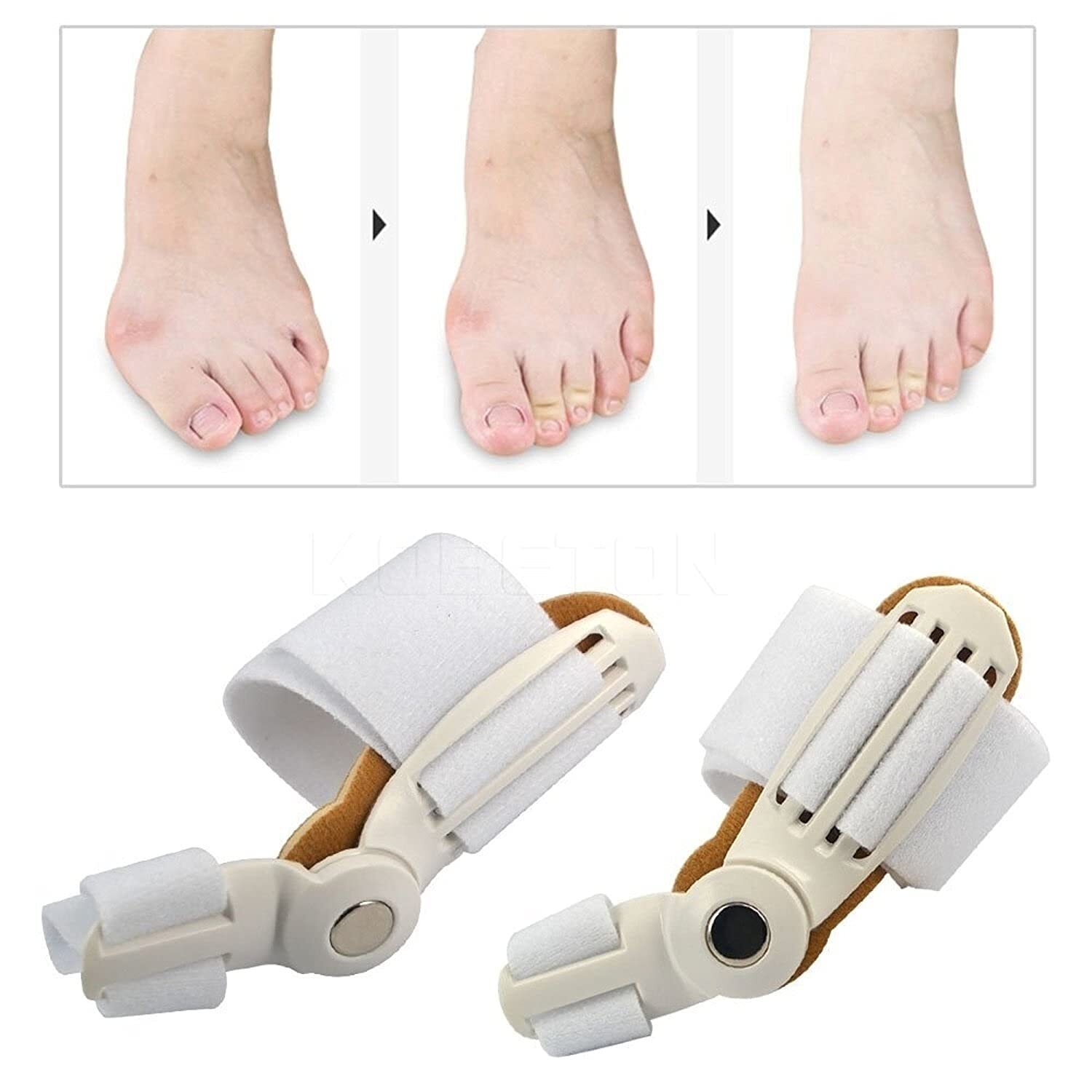 Toe Straightener - 15x10x5 Cm | Movable Bunion Aid Splint, Transversal Arch Support, Fits Both Left/right Foot, Pain Relief Design