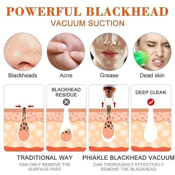 Multifunctional Blackhead Remover