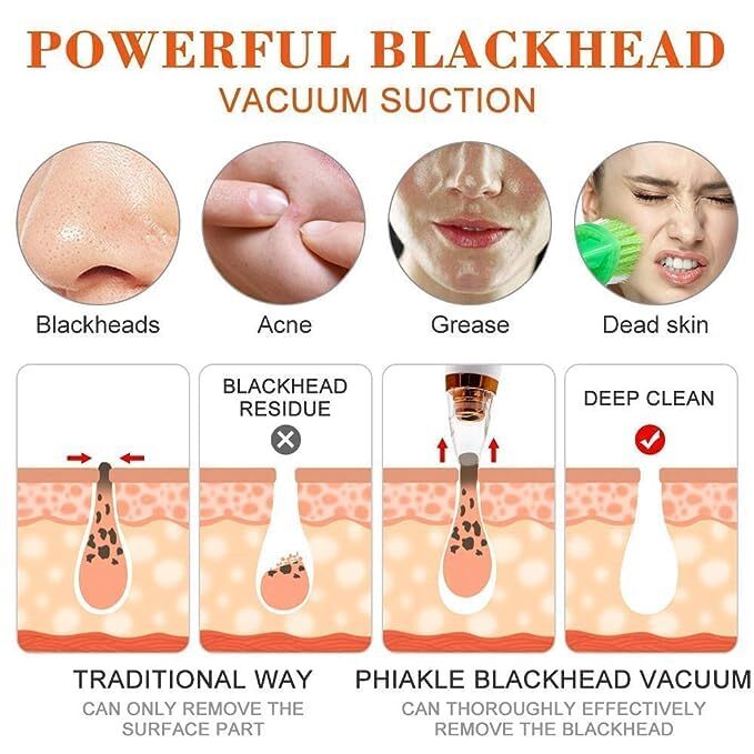 Professional Blackhead Remover - Eco-friendly Abs, 7x5x3.5 Cm | Usb Rechargeable, 6-in-1 Multi-function Pore Cleaner, Adjustable Suction Levels For All Skin Types