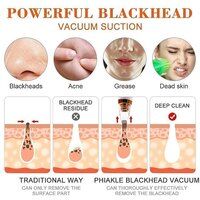 Multifunctional Blackhead Remover